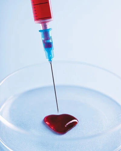 PRP (Platelet Rich Plasma) Tedavisi Sonrası Dikkat Edilmesi Gerekenler