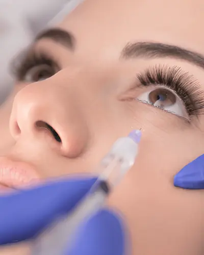 Göz Altı Mezoterapisi: Canlı ve Taze Bir Bakış