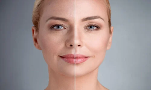 Vaccins Jeunesse Hydratants pour la Peau