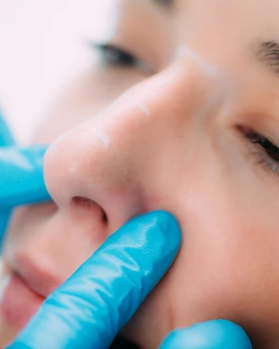 Hangi Burun Estetiği Sizin İçin Uygun?