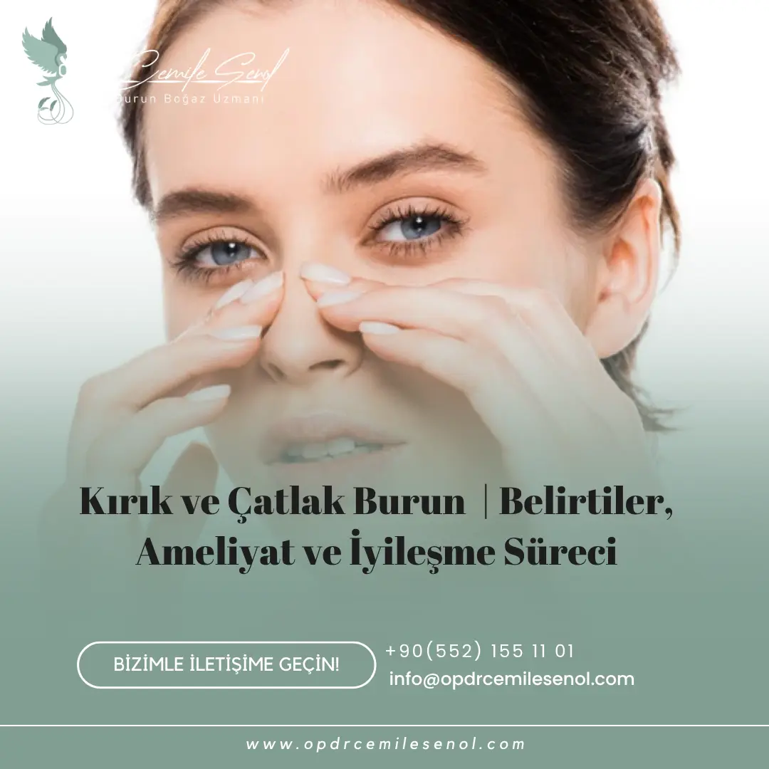 Burun kırığı belirtileri ameliyat ve iyileşme süreci - Op. Dr. Cemile Şenol Eskişehir