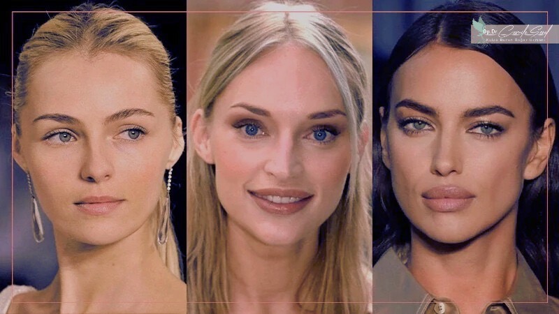 Rus burun yapısı özellikleri - Doğu Avrupa burun tipleri