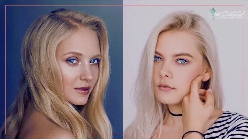 İskandinav burun yapısı düz hafif kavisli - burun şekilleri