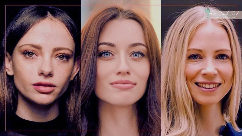 Kafkas burun yapısı Avrupa kökenli çeşitlilik - burun tipleri