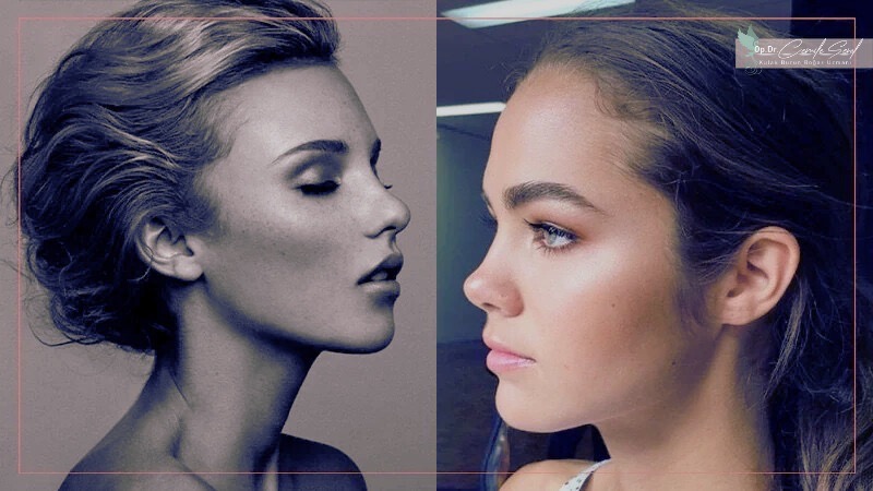 Kalkık küçük burun tipi snub nose - burun şekilleri