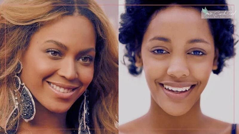 Nubian burun tipi - farklı etnik burun şekilleri